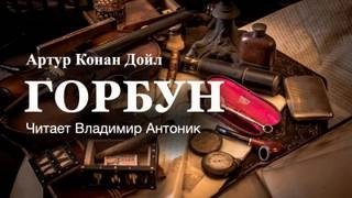 Горбун - Артур Конан Дойл Лучшие аудиокниги онлайн слушать бесплатно➝ Без остановки, полными циклами! ☆Более 100000 новых книг☆ ➝ Присоединяйтесь ✔️ audioknigi-onlain.com